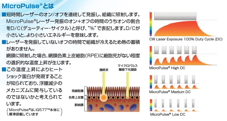 網膜虚血に対する網膜光凝固